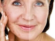 Anti Aging